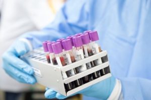 Leia mais sobre o artigo Tribunal catarinense inicia distribuição de kits para coleta de DNA em audiências de conciliação